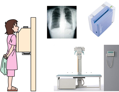 肺や心臓の病気を調べる「胸部X線検査(レントゲン)」