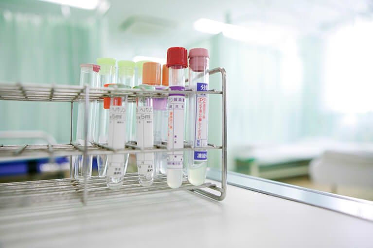 ヘモグロビン(HbA1c)の検査